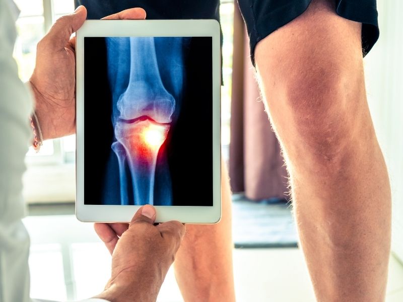 Ortopedista do Hospital Cajuru especialista em joelho